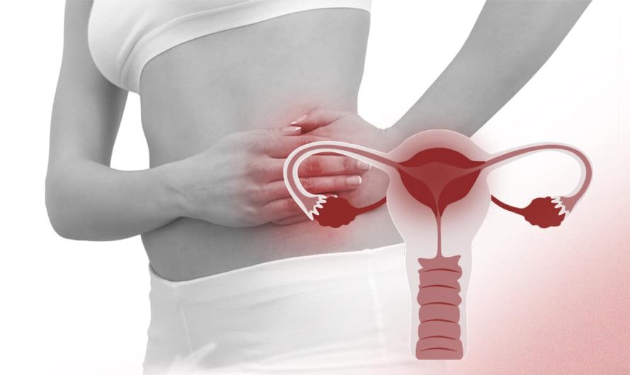 Pelvic Inflammatory Disease (PID) – Expert Care with Dr. Amit Tandon at Dr. Kamlesh Tandon Hospital, Agra