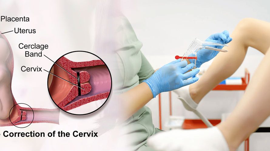 Cervical Stitch: A Vital Intervention for Twin Pregnancies Conceived through IVF