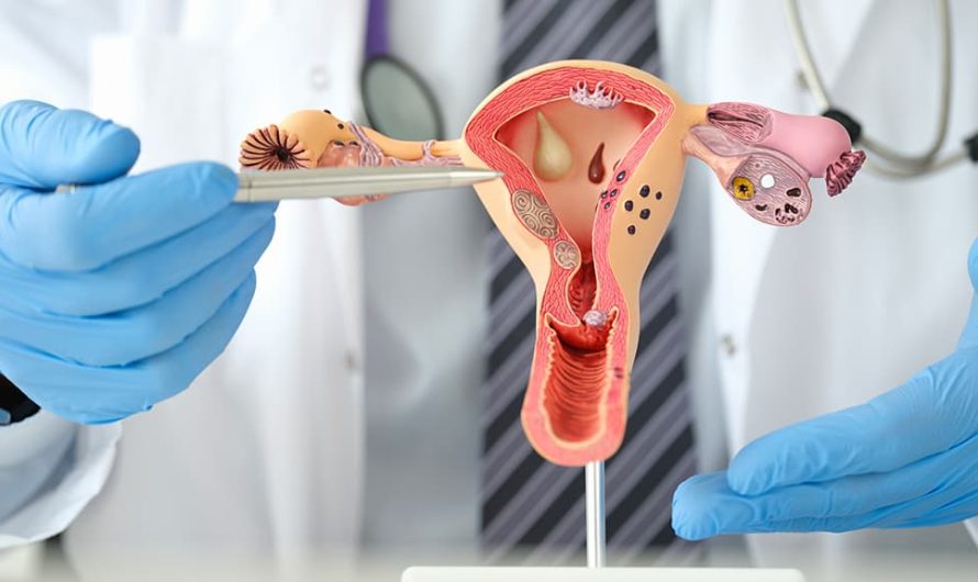 Blocked Fallopian Tubes: Understanding the Causes, Symptoms, and Treatment Options