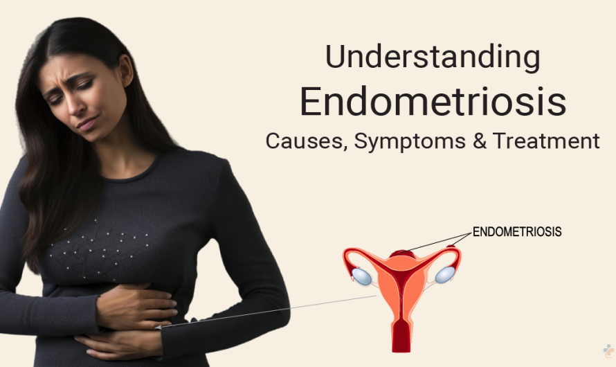 Understanding Endometriosis: Types and Treatment Options