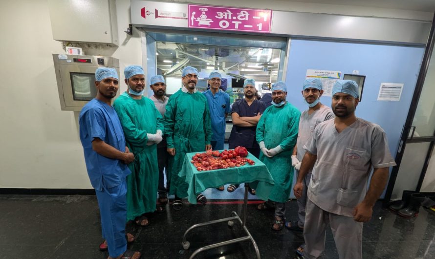 Medical Milestone in Agra: Over 500 Fibroids Removed in 5-Hour Surgery by Dr. Amit Tandon; Patient Recovering Well