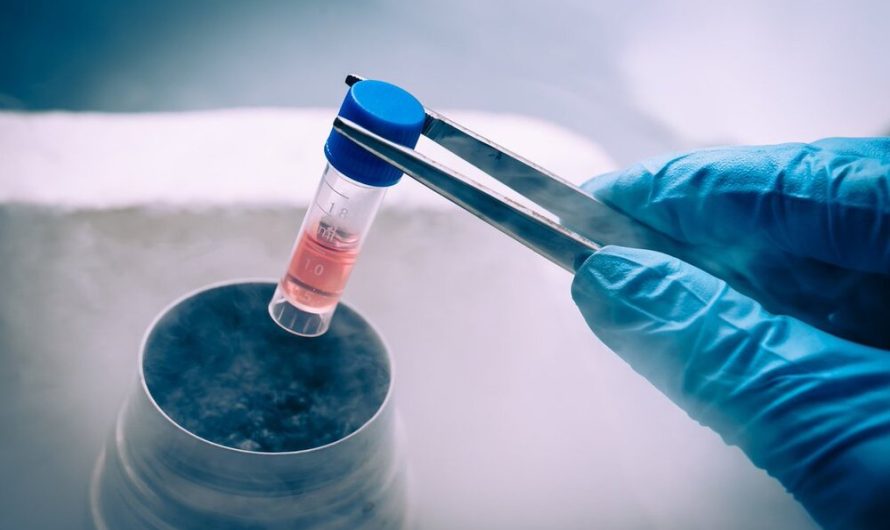 Fertility Preservation: How Robotic Myomectomy Can Save the Uterus